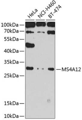 Western Blot: MS4A12 AntibodyBSA Free [NBP2-94041]